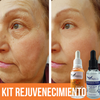 Kit Rejuvenecimiento Facial Ácido Hialurónico + Vitamina C